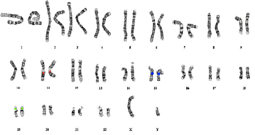 Hromosomas